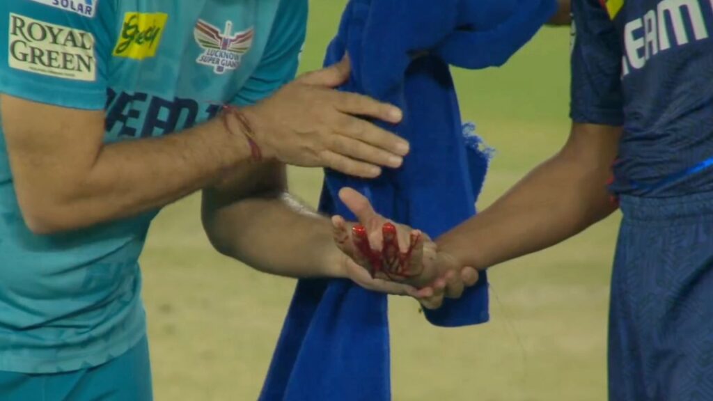 Akash-Singh-Hand-Bleeding-After-Being-Hit-By-Shubman-Gill.jpg